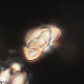 Heliolithus nefroeidis 62062