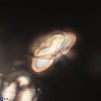 Heliolithus nefroeidis 62063