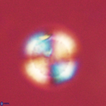 Heliolithus nefroeidis 62076