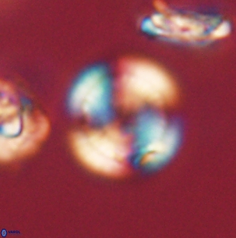 Heliolithus nefroeidis 62072