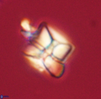 Heliolithus riedelii 61212