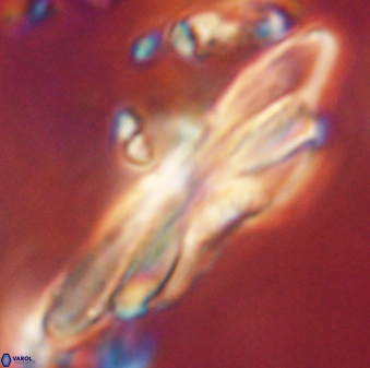Heliotrochus kleinpellii 62656