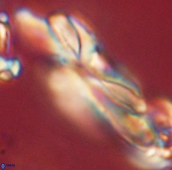 Heliotrochus kleinpellii 62661