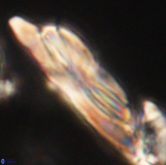 Heliotrochus kleinpellii 62663