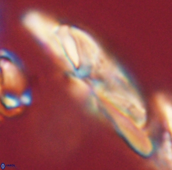 Heliotrochus kleinpellii 62667
