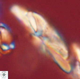 Heliotrochus kleinpellii 62667