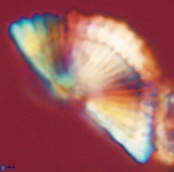 Heliotrochus kleinpellii 62672