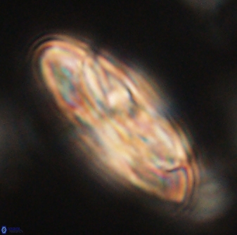 Heliotrochus kleinpellii 62693