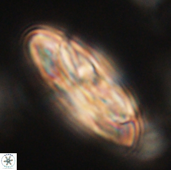 Heliotrochus kleinpellii 62693