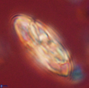 Heliotrochus kleinpellii 62694