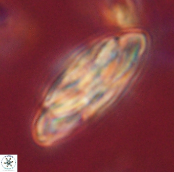 Heliotrochus kleinpellii 62702