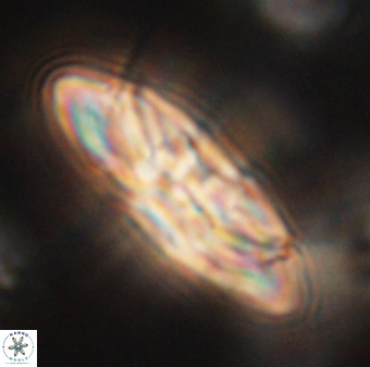 Heliotrochus kleinpellii 62705