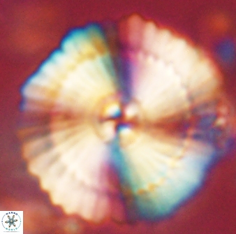 Heliotrochus kleinpellii 62719