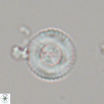 Heliotrochus steurbautetii 21232