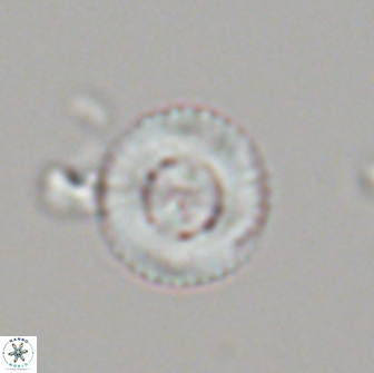 Heliotrochus steurbautetii 21233