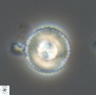 Heliotrochus steurbautetii 21234