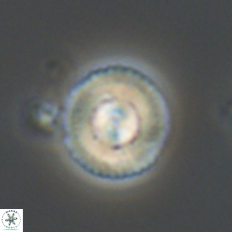 Heliotrochus steurbautetii 21236