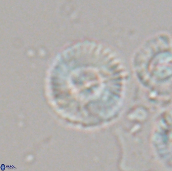 Heliotrochus steurbautetii 21609