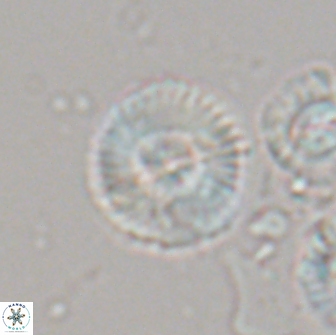 Heliotrochus steurbautetii 21609