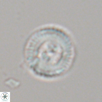 Heliotrochus steurbautetii 22079