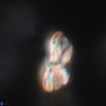 Heliotrochus steurbautetii 21607