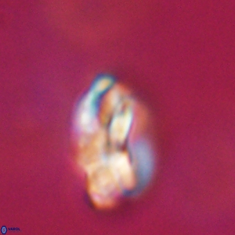Heliotrochus steurbautetii 21607