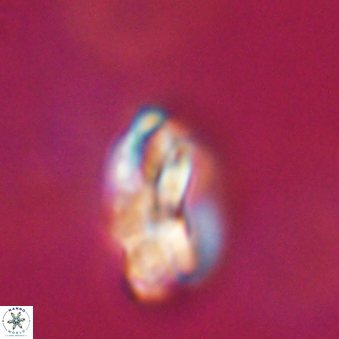 Heliotrochus steurbautetii 21607