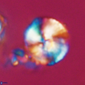 Heliotrochus steurbautetii 21607