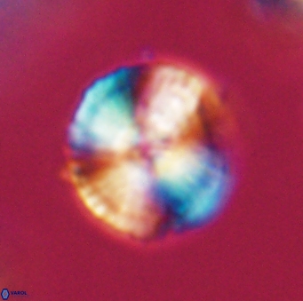 Heliotrochus steurbautetii 21607