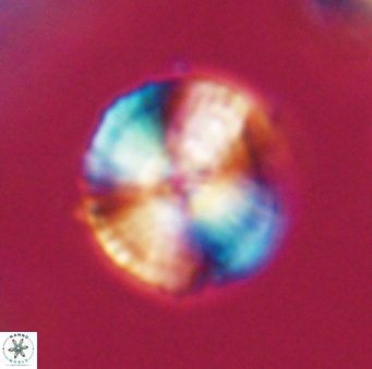 Heliotrochus steurbautetii 21607