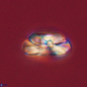 Heliotrochus steurbautii 55392