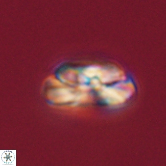 Heliotrochus steurbautii 55392