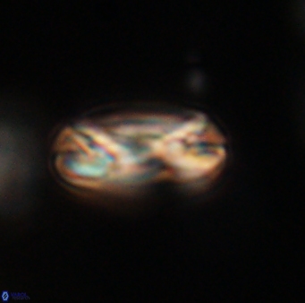 Heliotrochus trypa 63340