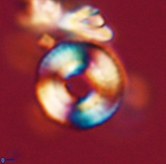 Heliotrochus trypa 63342