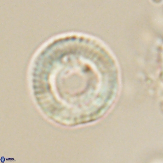 Heliotrochus trypa 63344