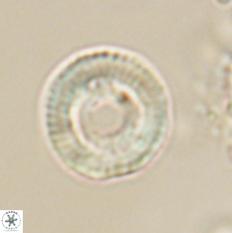 Heliotrochus trypa 63344