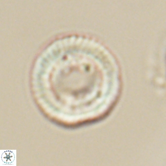 Heliotrochus trypa 63345