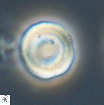 Heliotrochus trypa 63347