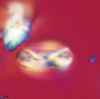 Heliotrochus trypa 63342