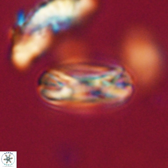 Heliotrochus trypa 63370