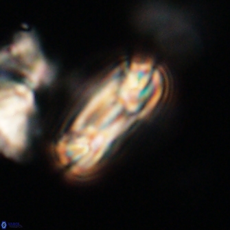 Heliotrochus trypa 63372