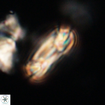 Heliotrochus trypa 63372