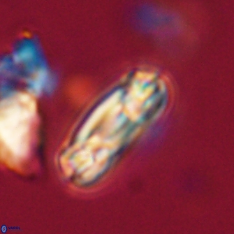 Heliotrochus trypa 63373