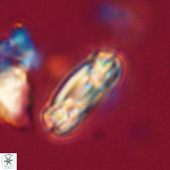 Heliotrochus trypa 63373