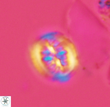 Heterorhabdus actinosus 4018