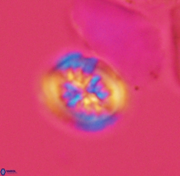 Heterorhabdus actinosus 4020