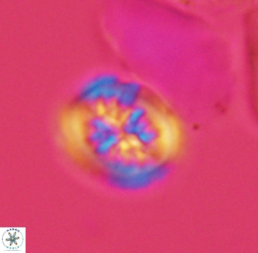 Heterorhabdus actinosus 4020