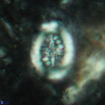 Heterorhabdus actinosus 6179