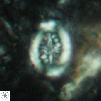 Heterorhabdus actinosus 6179