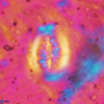 Heterorhabdus actinosus 6180